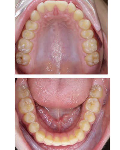 Before Image