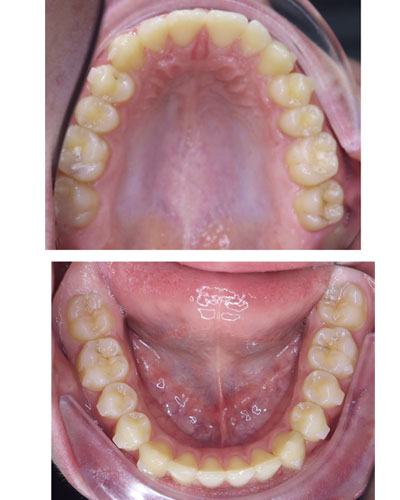 After Image