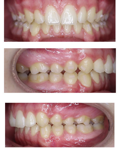 After Image