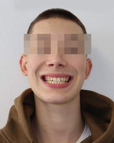 Before Image