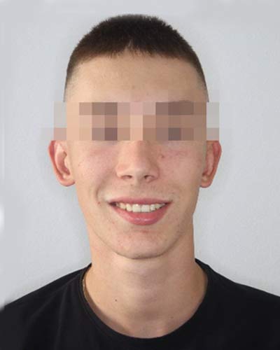 After Image